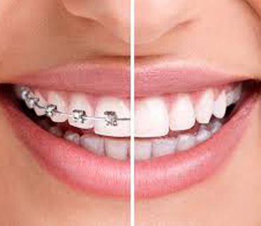 ORTHODONTICS