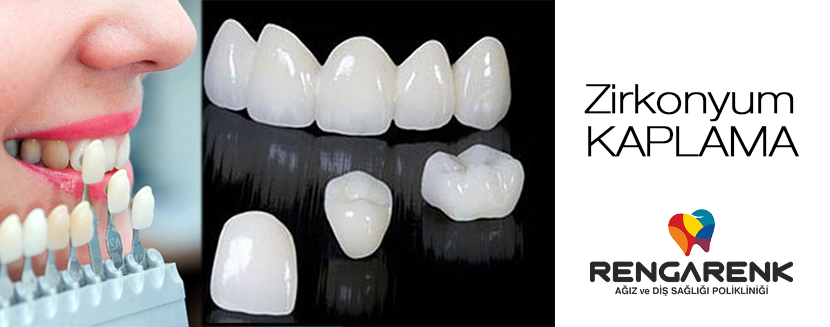 Zirconium Crowns