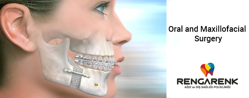 Maxillofacial Surgery Antalya